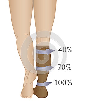 Medical compression hosiery