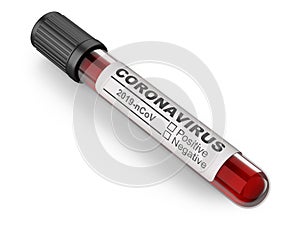 Medical container with blood for viral disease test on coronavirus COVID 19