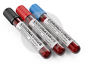 Medical containers with blood for viral disease test on coronavirus COVID 19