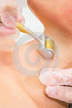 Medical cosmetic procedure