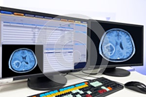 CT or MRI or PET Brain Scan film on a computer monitor. Technologically advanced and functional medical office