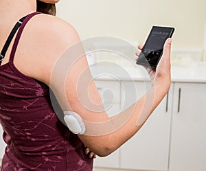 Medical device for glucose check. Continuous glucose monitoring pod. Modern wireless technology. photo