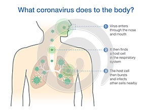 Medical diagram for explain about what coronavirus does to the body.