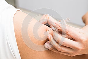 Medical doctor preparing to inject vaccine into the arm of a patient photo