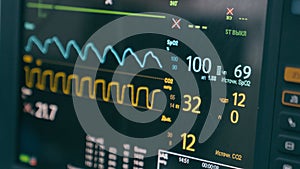 Medical equipment in hospital modern heart rate monitor in operating room display for monitoring patient vital signs