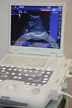 Medical Equipment ultrasound scanning.