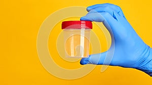 medical exam concept. perosn holds urine test cup over bright yellow background