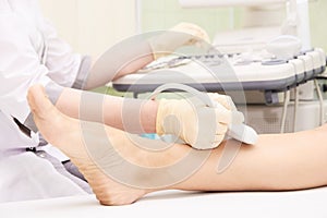 Medical examination. Patients leg. Ultrasonography