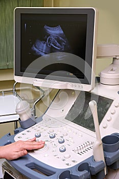 Medical examining pregnant belly by ultrasonic scan of a baby on