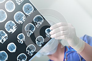 Medical experts studied the EEG condition of the patient