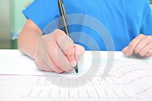 Medical experts are studying the ECG recording