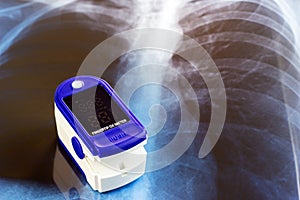 Medical fingertip pulse oximeter tool for oxygen saturation check during covid virus desease. SpO2 monitoring and heart rate