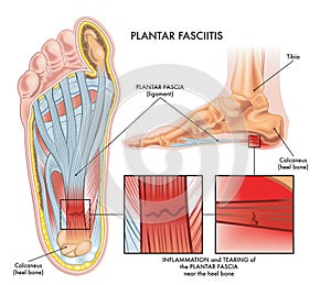 Medical foot illustration