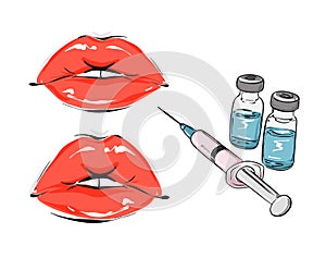 Medical glass bottles syringe lips implants infographic , lip fillers implants plastic syrgery icon