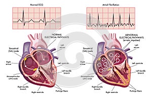 Medical heart diagrams