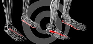 Medical illustration of the Abductor Hallucis