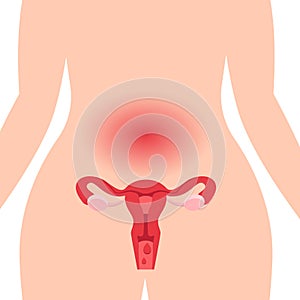 Medical illustration concept of healthy female reproductive system with the uterus and the ovaries.