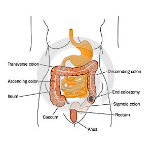 Medical,Illustration,medical illustration,medical photo