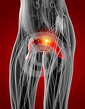 Medical  illustration of the pectineus