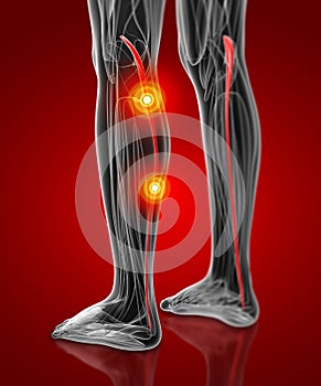 Medical  illustration of the plantaris