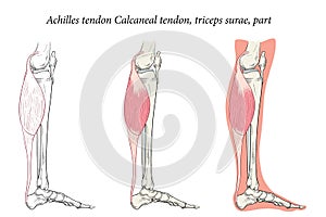 Medical illustration side view of Foot Achilles tendon Calcaneal tendon, triceps surae, part.