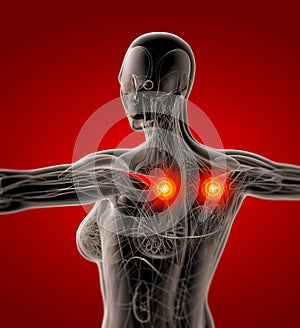 Medical  illustration of the supraspinatus