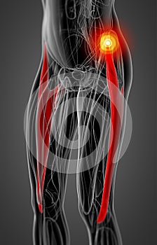 Medical  illustration of the  tensor fascia lata