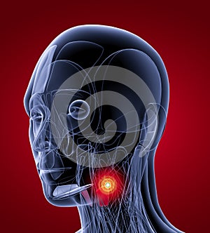 Medical  illustration of the thyrohyoid