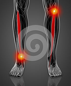 Medical  illustration of the tibialis anterior