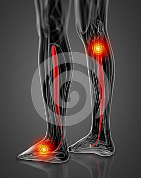 Medical  illustration of the tibialis posterior