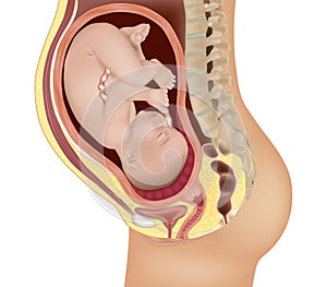 Medical illustration of the Total placenta previa. Complete previa photo