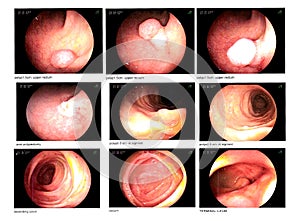 Medical image Gastrointestinal endoscopic examination image