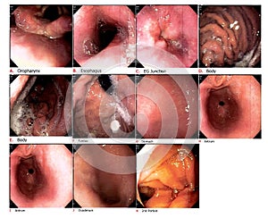 Medical image Gastrointestinal endoscopic examination image