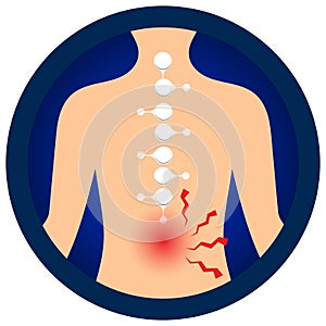 Medical infographic orthopedic; human silhouette. Abstract background with spine bone; cervical, Thoracic, Lumbar, and  Sacrum.