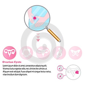 Medical infographic Ovarian cysts that could be causing women period pain.