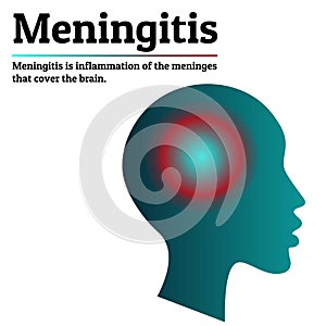 Medical infographic template. Meningitis - brain meninges inflammation. Human head silhouette with inflammation