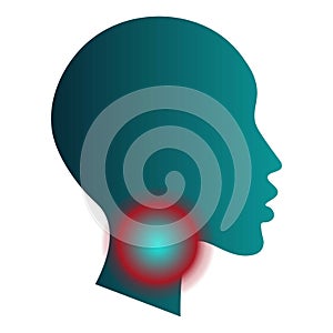 Medical infographic template - sore throat. Human head silhouette with pain localization sign mark. White background