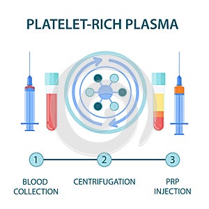 Medical infographics for platelet rich plasma procedure