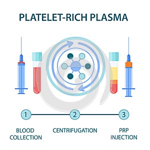Medical infographics for platelet rich plasma procedure photo