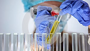 Medical lab worker marking tube with urine sample, checking bilirubin level