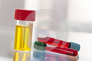 Medical laboratory : Sterile Urine sample and blood test