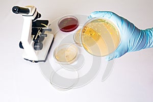 Medical laboratory testing for intestinal infection, E.coli bacterial infection in Petri dish