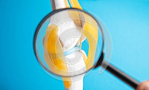 Medical mockup of a knee joint under a magnifying glass on a blue background. Knee ligament rupture and sprain concept