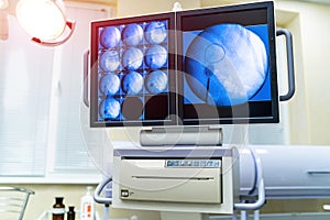 Medical monitor in surgery operating room. Professional monitor against the hospital room.