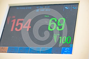 Medical monitor working show statistics in hospital