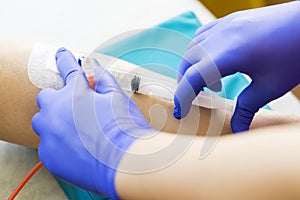 Medical nurse with blue latex gloves inputs liquid medicine by syringe to catheter in vein patient for chemotherapy or another iln