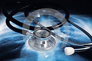 Stethoscope to auscultate patients over torax radiography for diagnosis of lung diseases photo