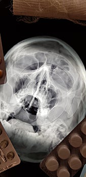 Medical pills and x-ray of the human head