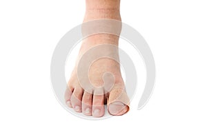 Medical plaster on the toe. White background with copy space. Close-up.