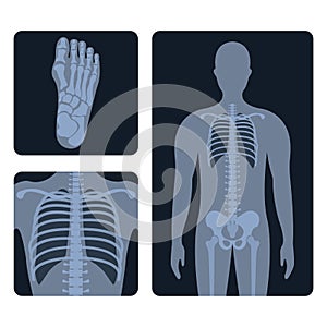 Different x-ray or radiographic images of human body bones and parts photo
